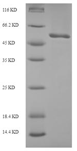 (Tris-Glycine gel) Discontinuous SDS-PAGE (reduced) with 5% enrichment gel and 15% separation gel. (Tris-Glycine gel) Discontinuous SDS-PAGE (reduced) with 5% enrichment gel and 15% separation gel.