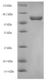 (Tris-Glycine gel) Discontinuous SDS-PAGE (reduced) with 5% enrichment gel and 15% separation gel.