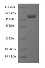 (Tris-Glycine gel) Discontinuous SDS-PAGE (reduced) with 5% enrichment gel and 15% separation gel. (Tris-Glycine gel) Discontinuous SDS-PAGE (reduced) with 5% enrichment gel and 15% separation gel.