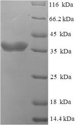 (Tris-Glycine gel) Discontinuous SDS-PAGE (reduced) with 5% enrichment gel and 15% separation gel. (Tris-Glycine gel) Discontinuous SDS-PAGE (reduced) with 5% enrichment gel and 15% separation gel.