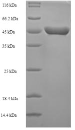(Tris-Glycine gel) Discontinuous SDS-PAGE (reduced) with 5% enrichment gel and 15% separation gel.