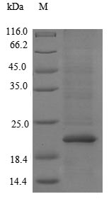 (Tris-Glycine gel) Discontinuous SDS-PAGE (reduced) with 5% enrichment gel and 15% separation gel. (Tris-Glycine gel) Discontinuous SDS-PAGE (reduced) with 5% enrichment gel and 15% separation gel.