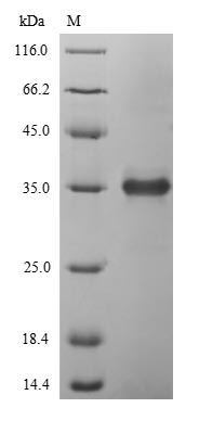 (Tris-Glycine gel) Discontinuous SDS-PAGE (reduced) with 5% enrichment gel and 15% separation gel. (Tris-Glycine gel) Discontinuous SDS-PAGE (reduced) with 5% enrichment gel and 15% separation gel.