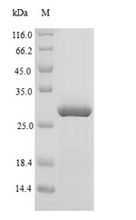 (Tris-Glycine gel) Discontinuous SDS-PAGE (reduced) with 5% enrichment gel and 15% separation gel.