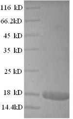 (Tris-Glycine gel) Discontinuous SDS-PAGE (reduced) with 5% enrichment gel and 15% separation gel. (Tris-Glycine gel) Discontinuous SDS-PAGE (reduced) with 5% enrichment gel and 15% separation gel.