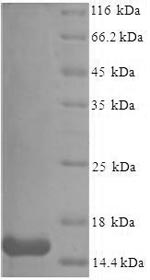 (Tris-Glycine gel) Discontinuous SDS-PAGE (reduced) with 5% enrichment gel and 15% separation gel. (Tris-Glycine gel) Discontinuous SDS-PAGE (reduced) with 5% enrichment gel and 15% separation gel.