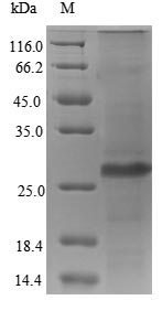 SDS-PAGE- Recombinant protein Human UL83