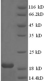 (Tris-Glycine gel) Discontinuous SDS-PAGE (reduced) with 5% enrichment gel and 15% separation gel. (Tris-Glycine gel) Discontinuous SDS-PAGE (reduced) with 5% enrichment gel and 15% separation gel.