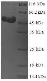 (Tris-Glycine gel) Discontinuous SDS-PAGE (reduced) with 5% enrichment gel and 15% separation gel.