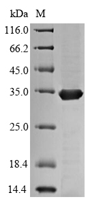 SDS-PAGE- Recombinant protein Mycobacterium fbpC