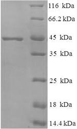 (Tris-Glycine gel) Discontinuous SDS-PAGE (reduced) with 5% enrichment gel and 15% separation gel.