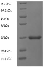 SDS-PAGE- Recombinant protein Mycobacterium esxH