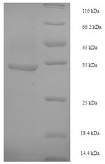 (Tris-Glycine gel) Discontinuous SDS-PAGE (reduced) with 5% enrichment gel and 15% separation gel. (Tris-Glycine gel) Discontinuous SDS-PAGE (reduced) with 5% enrichment gel and 15% separation gel.