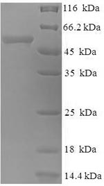 (Tris-Glycine gel) Discontinuous SDS-PAGE (reduced) with 5% enrichment gel and 15% separation gel.