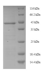 (Tris-Glycine gel) Discontinuous SDS-PAGE (reduced) with 5% enrichment gel and 15% separation gel. (Tris-Glycine gel) Discontinuous SDS-PAGE (reduced) with 5% enrichment gel and 15% separation gel.