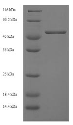 (Tris-Glycine gel) Discontinuous SDS-PAGE (reduced) with 5% enrichment gel and 15% separation gel. (Tris-Glycine gel) Discontinuous SDS-PAGE (reduced) with 5% enrichment gel and 15% separation gel.