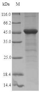 (Tris-Glycine gel) Discontinuous SDS-PAGE (reduced) with 5% enrichment gel and 15% separation gel.