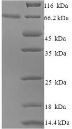 (Tris-Glycine gel) Discontinuous SDS-PAGE (reduced) with 5% enrichment gel and 15% separation gel. (Tris-Glycine gel) Discontinuous SDS-PAGE (reduced) with 5% enrichment gel and 15% separation gel.