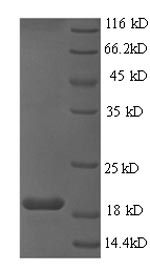 CSB-EP365854HML SDS-PAGE