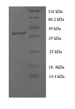 SDS-PAGE- Recombinant protein Human E7