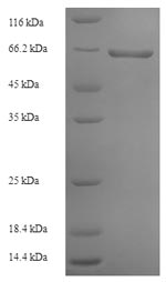 SDS-PAGE- Recombinant protein Rabies G