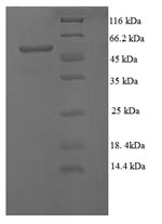 (Tris-Glycine gel) Discontinuous SDS-PAGE (reduced) with 5% enrichment gel and 15% separation gel. (Tris-Glycine gel) Discontinuous SDS-PAGE (reduced) with 5% enrichment gel and 15% separation gel.