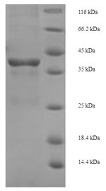 (Tris-Glycine gel) Discontinuous SDS-PAGE (reduced) with 5% enrichment gel and 15% separation gel. (Tris-Glycine gel) Discontinuous SDS-PAGE (reduced) with 5% enrichment gel and 15% separation gel.