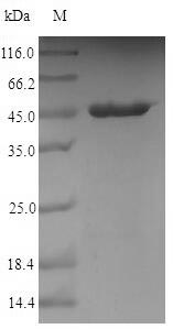 (Tris-Glycine gel) Discontinuous SDS-PAGE (reduced) with 5% enrichment gel and 15% separation gel. (Tris-Glycine gel) Discontinuous SDS-PAGE (reduced) with 5% enrichment gel and 15% separation gel.