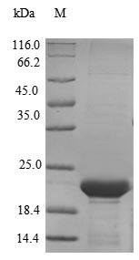 (Tris-Glycine gel) Discontinuous SDS-PAGE (reduced) with 5% enrichment gel and 15% separation gel. (Tris-Glycine gel) Discontinuous SDS-PAGE (reduced) with 5% enrichment gel and 15% separation gel.