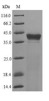 (Tris-Glycine gel) Discontinuous SDS-PAGE (reduced) with 5% enrichment gel and 15% separation gel.