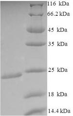 (Tris-Glycine gel) Discontinuous SDS-PAGE (reduced) with 5% enrichment gel and 15% separation gel. (Tris-Glycine gel) Discontinuous SDS-PAGE (reduced) with 5% enrichment gel and 15% separation gel.