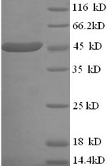SDS-PAGE- Recombinant protein Escherichia lldD