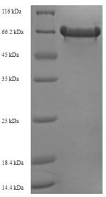 (Tris-Glycine gel) Discontinuous SDS-PAGE (reduced) with 5% enrichment gel and 15% separation gel. (Tris-Glycine gel) Discontinuous SDS-PAGE (reduced) with 5% enrichment gel and 15% separation gel.