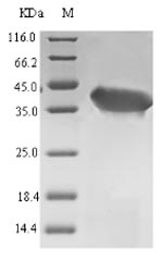 (Tris-Glycine gel) Discontinuous SDS-PAGE (reduced) with 5% enrichment gel and 15% separation gel. (Tris-Glycine gel) Discontinuous SDS-PAGE (reduced) with 5% enrichment gel and 15% separation gel.