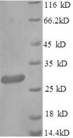 SDS-PAGE- Recombinant protein Klebsiella blaNDM-1