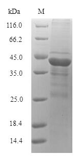 (Tris-Glycine gel) Discontinuous SDS-PAGE (reduced) with 5% enrichment gel and 15% separation gel.
