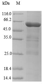 (Tris-Glycine gel) Discontinuous SDS-PAGE (reduced) with 5% enrichment gel and 15% separation gel. (Tris-Glycine gel) Discontinuous SDS-PAGE (reduced) with 5% enrichment gel and 15% separation gel.