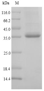 (Tris-Glycine gel) Discontinuous SDS-PAGE (reduced) with 5% enrichment gel and 15% separation gel. (Tris-Glycine gel) Discontinuous SDS-PAGE (reduced) with 5% enrichment gel and 15% separation gel.