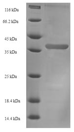 SDS-PAGE- Recombinant protein Aeromonas fkpA