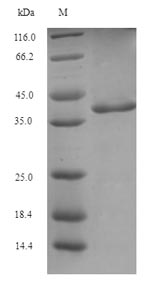 (Tris-Glycine gel) Discontinuous SDS-PAGE (reduced) with 5% enrichment gel and 15% separation gel.