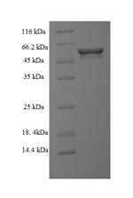 (Tris-Glycine gel) Discontinuous SDS-PAGE (reduced) with 5% enrichment gel and 15% separation gel. (Tris-Glycine gel) Discontinuous SDS-PAGE (reduced) with 5% enrichment gel and 15% separation gel.