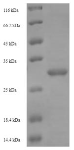(Tris-Glycine gel) Discontinuous SDS-PAGE (reduced) with 5% enrichment gel and 15% separation gel.