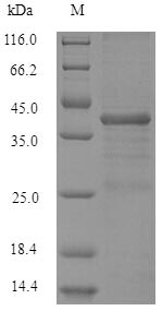 (Tris-Glycine gel) Discontinuous SDS-PAGE (reduced) with 5% enrichment gel and 15% separation gel. (Tris-Glycine gel) Discontinuous SDS-PAGE (reduced) with 5% enrichment gel and 15% separation gel.