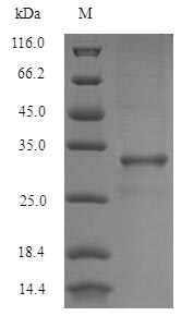(Tris-Glycine gel) Discontinuous SDS-PAGE (reduced) with 5% enrichment gel and 15% separation gel. (Tris-Glycine gel) Discontinuous SDS-PAGE (reduced) with 5% enrichment gel and 15% separation gel.