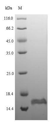 SDS-PAGE- Recombinant protein Escherichia glpE