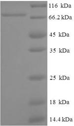 (Tris-Glycine gel) Discontinuous SDS-PAGE (reduced) with 5% enrichment gel and 15% separation gel. (Tris-Glycine gel) Discontinuous SDS-PAGE (reduced) with 5% enrichment gel and 15% separation gel.