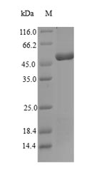 (Tris-Glycine gel) Discontinuous SDS-PAGE (reduced) with 5% enrichment gel and 15% separation gel.