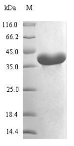 (Tris-Glycine gel) Discontinuous SDS-PAGE (reduced) with 5% enrichment gel and 15% separation gel. (Tris-Glycine gel) Discontinuous SDS-PAGE (reduced) with 5% enrichment gel and 15% separation gel.