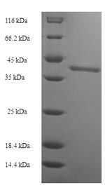 CSB-EP613674HU