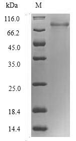 (Tris-Glycine gel) Discontinuous SDS-PAGE (reduced) with 5% enrichment gel and 15% separation gel. (Tris-Glycine gel) Discontinuous SDS-PAGE (reduced) with 5% enrichment gel and 15% separation gel.